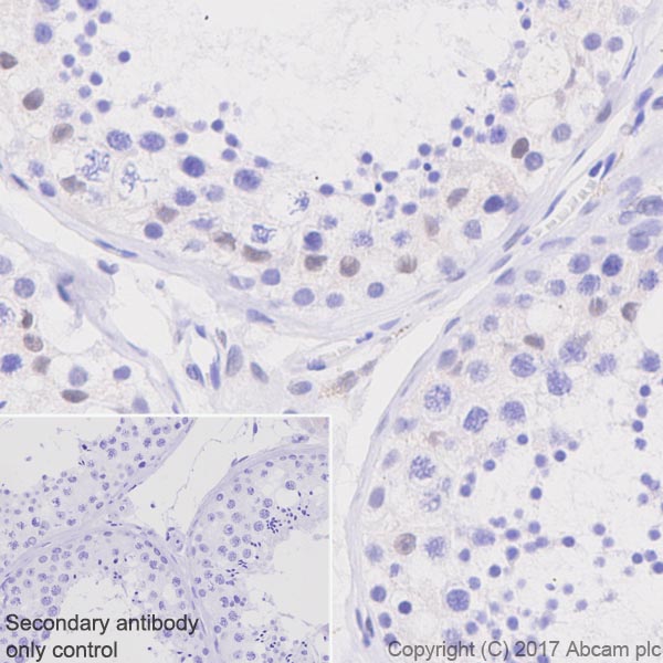 Immunohistochemistry (Formalin/PFA-fixed paraffin-embedded sections) - Anti-TFE3 antibody [EPR11591] - BSA and Azide free (AB231112), expandable thumbnail