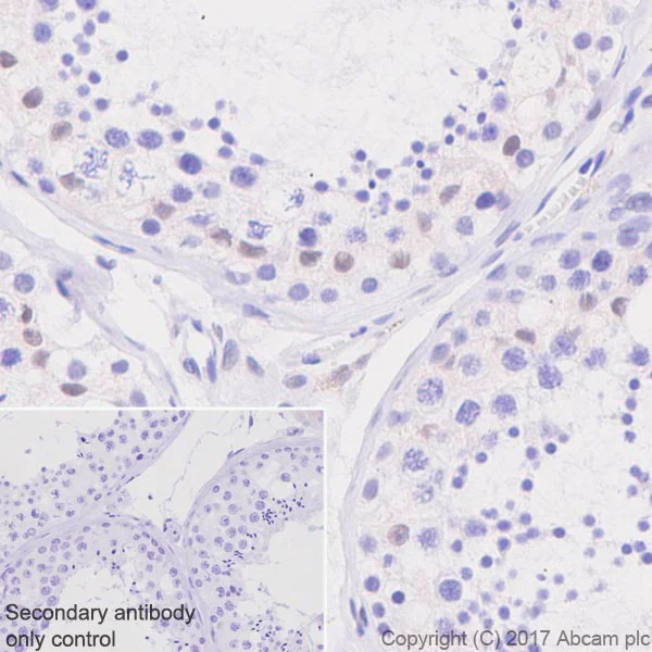 Immunohistochemistry (Formalin/PFA-fixed paraffin-embedded sections) - Anti-TFE3 antibody [EPR11591] - BSA and Azide free (AB231112)