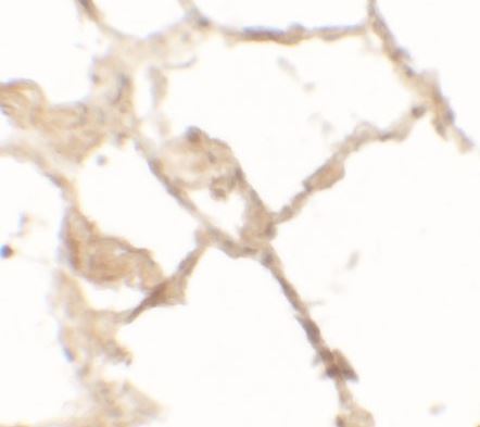 Immunohistochemistry (Formalin/PFA-fixed paraffin-embedded sections) - Anti-TFEB antibody (AB181342)