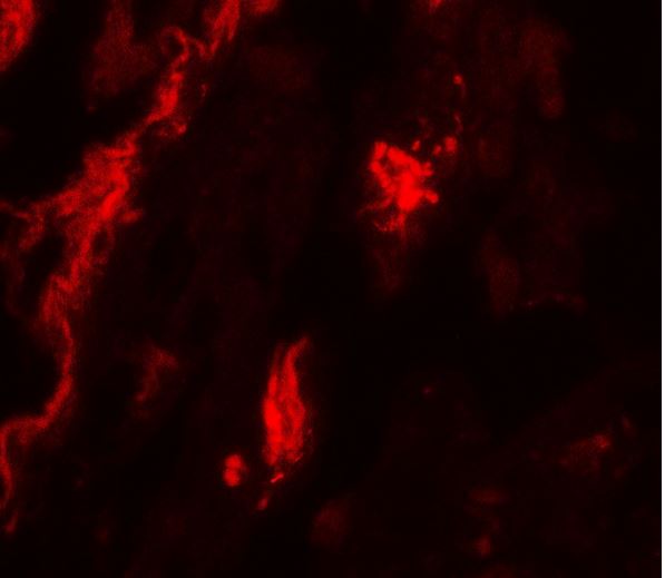 Immunohistochemistry (Formalin/PFA-fixed paraffin-embedded sections) - Anti-TFEB antibody (AB181342)