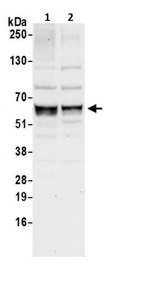 Western blot - Anti-TFEB antibody (AB245349)
