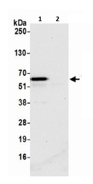 Immunoprecipitation - Anti-TFEB antibody (AB245350), expandable thumbnail