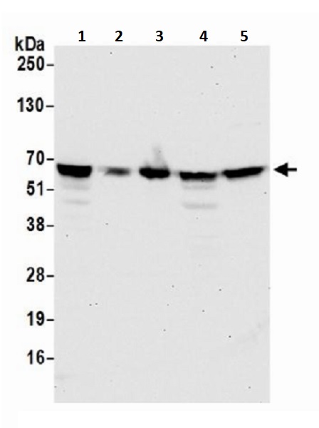 Western blot - Anti-TFEB antibody (AB245350), expandable thumbnail
