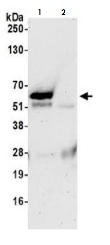 Immunoprecipitation - Anti-TFEB antibody [BLR070G] (AB264421), expandable thumbnail