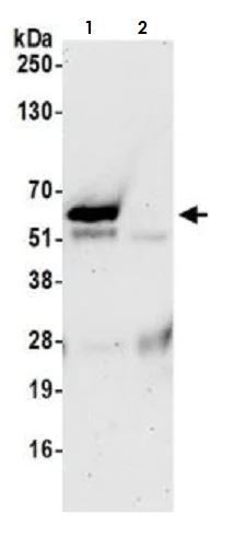 Immunoprecipitation - Anti-TFEB antibody [BLR070G] (AB264421)