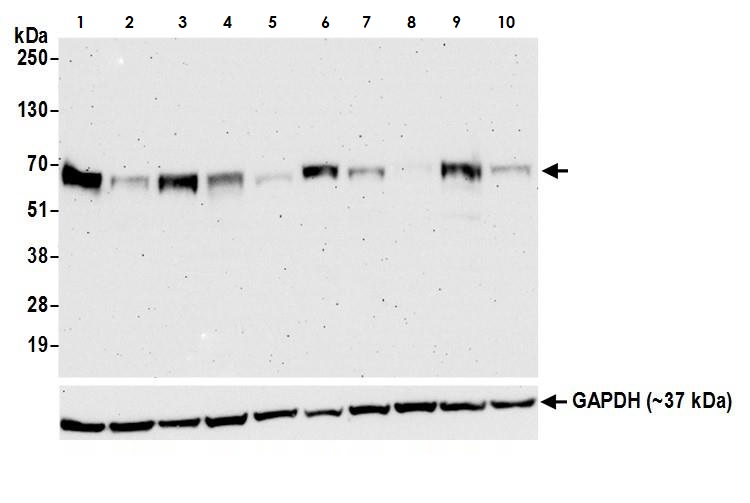Western blot - Anti-TFEB antibody [BLR070G] (AB264421), expandable thumbnail