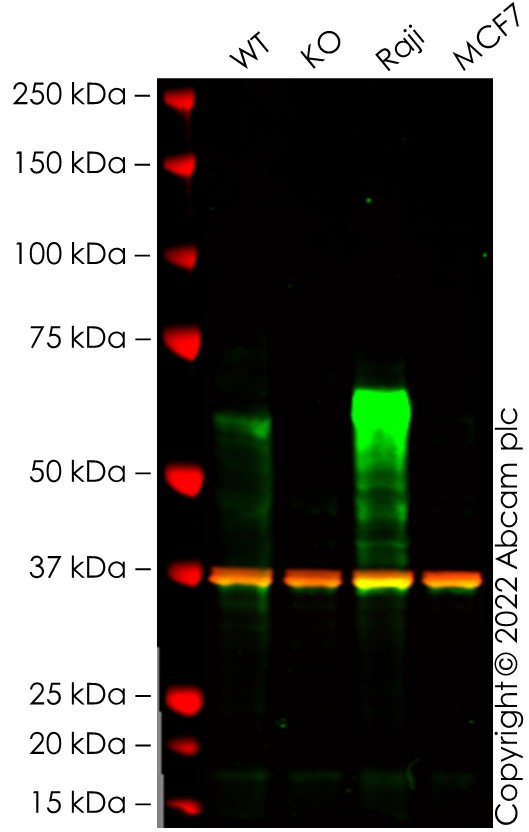 Western blot - Anti-TFEB antibody [BLR070G] (AB264421), expandable thumbnail