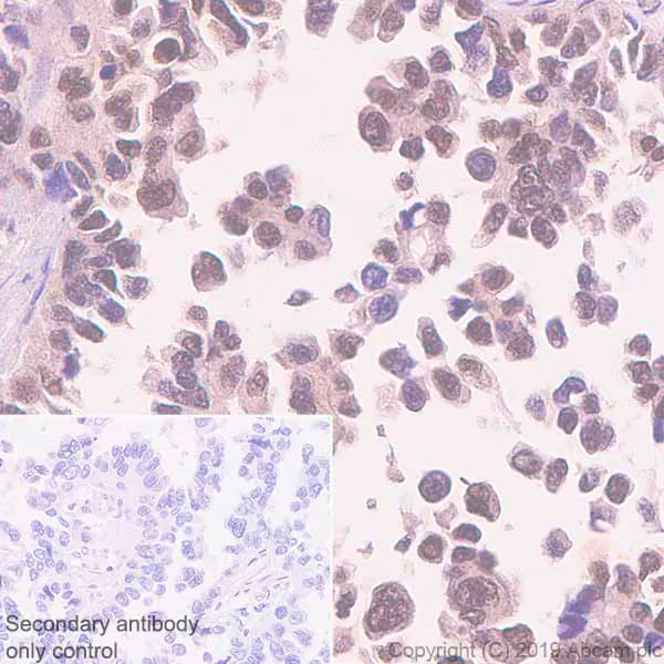 Immunohistochemistry (Formalin/PFA-fixed paraffin-embedded sections) - Anti-TFEB antibody [EPR22940-151] (AB270604)