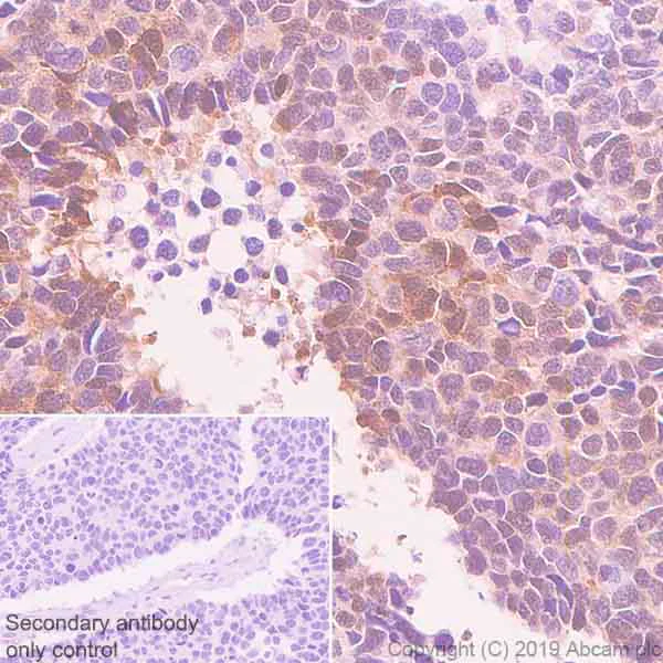 Immunohistochemistry (Formalin/PFA-fixed paraffin-embedded sections) - Anti-TFEB antibody [EPR22941-6] (AB267351)