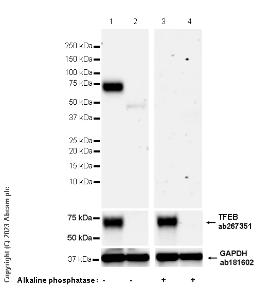 Western blot - Anti-TFEB (phospho S211) antibody [EPR27960-64] (AB310331)