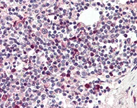 Immunohistochemistry (Formalin/PFA-fixed paraffin-embedded sections) - Anti-TFEC antibody (AB115569)