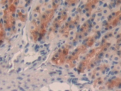 Immunohistochemistry (Formalin/PFA-fixed paraffin-embedded sections) - Anti-TFF2 antibody [1-2#] (AB239488), expandable thumbnail