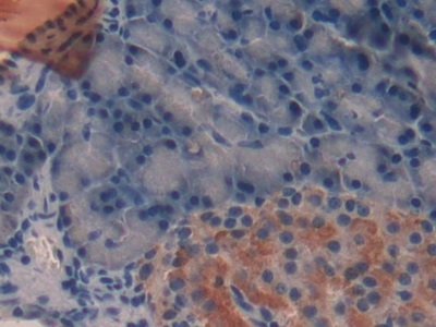 Immunohistochemistry (Formalin/PFA-fixed paraffin-embedded sections) - Anti-TFF2 antibody [1-2#] (AB239488), expandable thumbnail