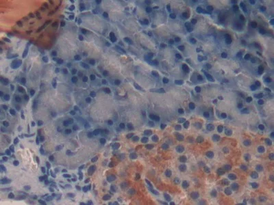 Immunohistochemistry (Formalin/PFA-fixed paraffin-embedded sections) - Anti-TFF2 antibody [1-2#] (AB239488)