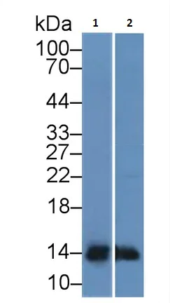 Western blot - Anti-TFF2 antibody [1-2#] (AB239488)