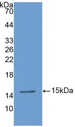 Western blot - Anti-TFF2 antibody [1-2#] (AB239488)