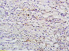 Immunohistochemistry (Formalin/PFA-fixed paraffin-embedded sections) - Anti-TFF2 antibody (AB203237), expandable thumbnail