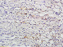 Immunohistochemistry (Formalin/PFA-fixed paraffin-embedded sections) - Anti-TFF2 antibody (AB203237)