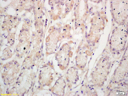 Immunohistochemistry (Formalin/PFA-fixed paraffin-embedded sections) - Anti-TFF2 antibody (AB203237)