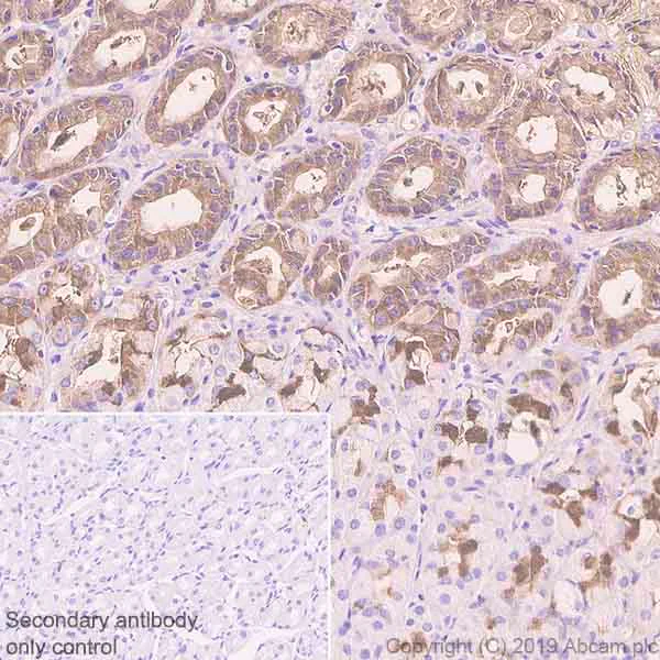 Immunohistochemistry (Formalin/PFA-fixed paraffin-embedded sections) - Anti-TFF2 antibody [EPR23231-208] (AB267474)