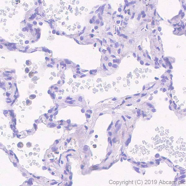 Immunohistochemistry (Formalin/PFA-fixed paraffin-embedded sections) - Anti-TFF2 antibody [EPR23231-208] - BSA and Azide free (AB269862)