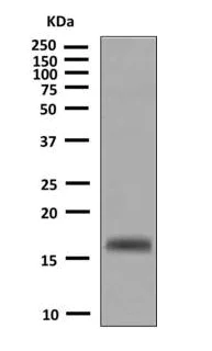 Western blot - Anti-TFF2 antibody [EPR6346(2)] (AB140645)