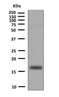 Western blot - Anti-TFF2 antibody [EPR6346(2)] - BSA and Azide free (AB248927), expandable thumbnail