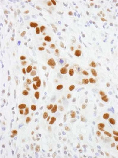 Immunohistochemistry (Formalin/PFA-fixed paraffin-embedded sections) - Anti-TFII I antibody (AB264198)