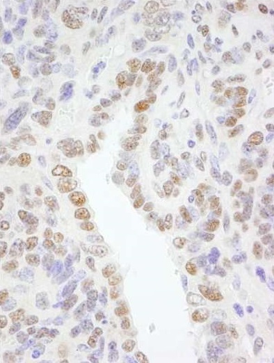 Immunohistochemistry (Formalin/PFA-fixed paraffin-embedded sections) - Anti-TFII I antibody (AB264198)