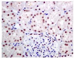 Immunohistochemistry (Formalin/PFA-fixed paraffin-embedded sections) - Anti-TFII I antibody [EPR7696] (AB134133)