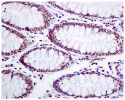 Immunohistochemistry (Formalin/PFA-fixed paraffin-embedded sections) - Anti-TFII I antibody [EPR7696] - BSA and Azide free (AB185640)