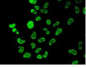 Immunocytochemistry/ Immunofluorescence - Anti-TFII I antibody [EPR7697] - BSA and Azide free (AB248269), expandable thumbnail