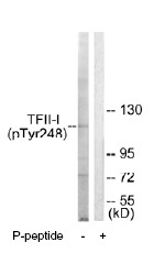 Western blot - Anti-TFII I (phospho Y248) antibody (AB63344)