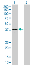 Western blot - TFIIB overexpression 293T lysate (whole cell) (AB94155)