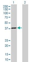 Western blot - TFIIB overexpression 293T lysate (whole cell) (AB94155)
