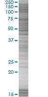 TFIIB overexpression 293T lysate (whole cell)