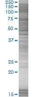 SDS-PAGE - TFIIB overexpression 293T lysate (whole cell) (AB94156)
