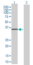 Western blot - TFIIB overexpression 293T lysate (whole cell) (AB94156)