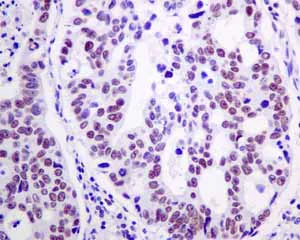 Immunohistochemistry (Formalin/PFA-fixed paraffin-embedded sections) - Anti-TFIIE alpha/GTF2E1 antibody [EPR8377(2)] (AB140634)