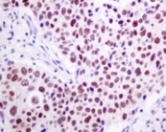 Immunohistochemistry (Formalin/PFA-fixed paraffin-embedded sections) - Anti-TFIIE alpha/GTF2E1 antibody [EPR8377(2)] (AB140634)
