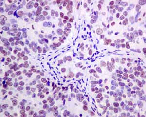 Immunohistochemistry (Formalin/PFA-fixed paraffin-embedded sections) - Anti-TFIIE alpha/GTF2E1 antibody [EPR8377(2)] (AB140634)