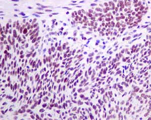 Immunohistochemistry (Formalin/PFA-fixed paraffin-embedded sections) - Anti-TFIIE alpha/GTF2E1 antibody [EPR8377(2)] (AB140634)