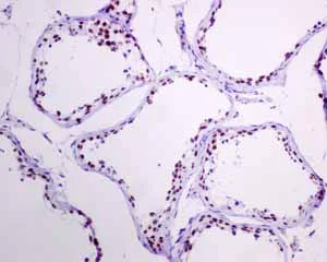 Immunohistochemistry (Formalin/PFA-fixed paraffin-embedded sections) - Anti-TFIIE alpha/GTF2E1 antibody [EPR8377(2)] (AB140634)
