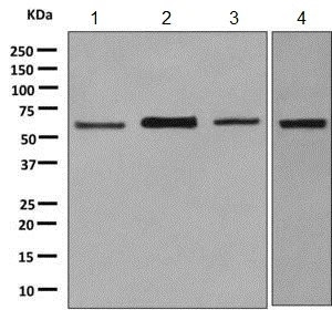 Western blot - Anti-TFIIE alpha/GTF2E1 antibody [EPR8377(2)] (AB140634)