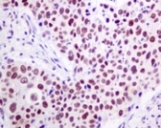 Immunohistochemistry (Formalin/PFA-fixed paraffin-embedded sections) - Anti-TFIIE alpha/GTF2E1 antibody [EPR8377(2)] - BSA and Azide free (AB248917)