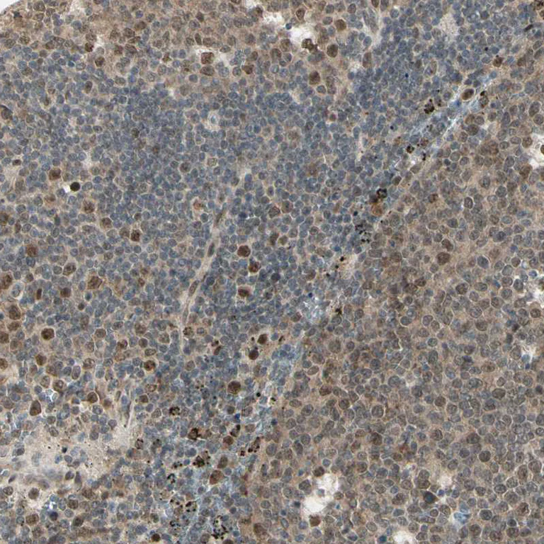 Immunohistochemistry (Formalin/PFA-fixed paraffin-embedded sections) - Anti-TFIIIA antibody (AB254632)