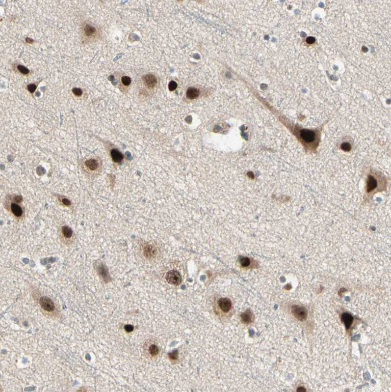 ち*ぷ様 ディアステマDiastema cf. fimbriatoloba Lamp1 Antibody (1D4B) - DSHB