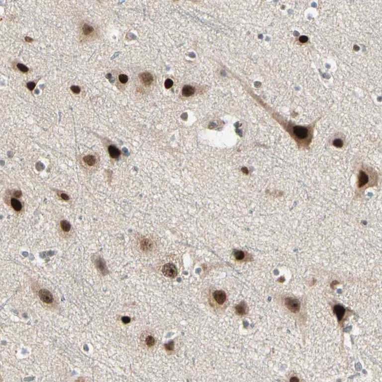 Immunohistochemistry (Formalin/PFA-fixed paraffin-embedded sections) - Anti-TFIIIA antibody (AB254632)