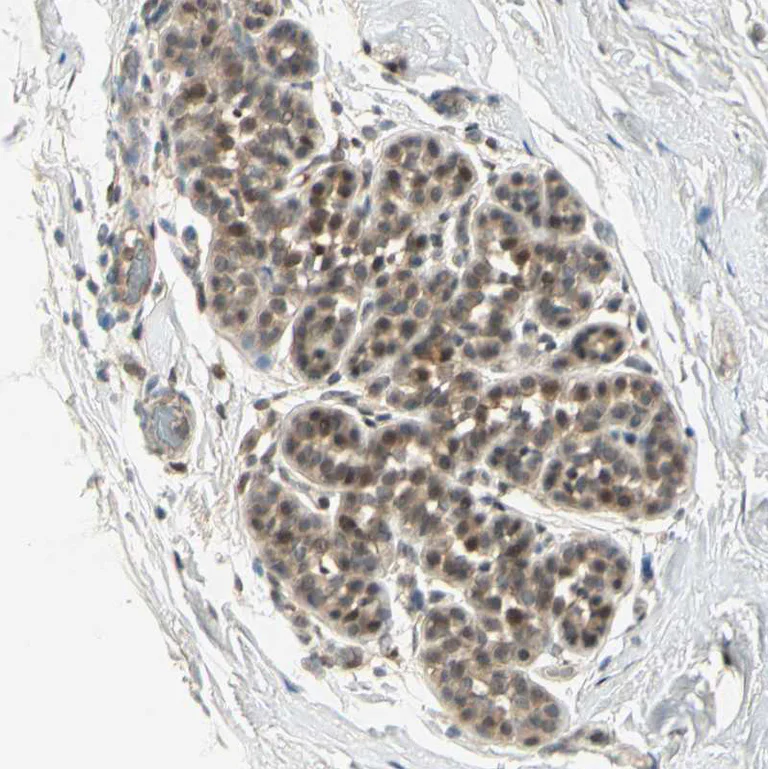 Immunohistochemistry (Formalin/PFA-fixed paraffin-embedded sections) - Anti-TFIIIA antibody (AB254632)