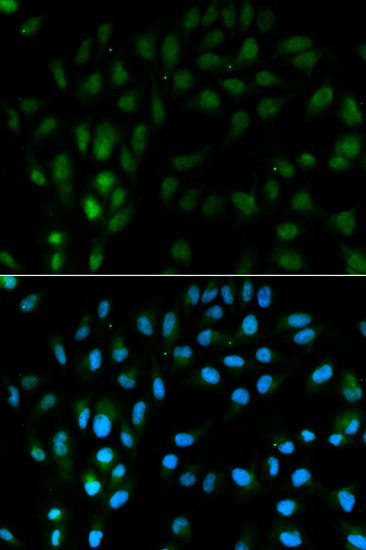 Immunocytochemistry/ Immunofluorescence - Anti-TFPI antibody (AB180619), expandable thumbnail